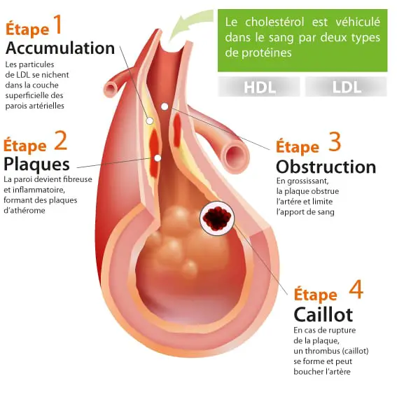 mauvais cholesterol effet