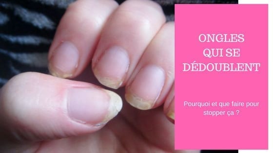 traitement ongles qui se dedoublent