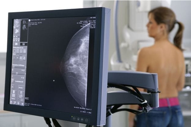 depistage cancer du sein mammographie