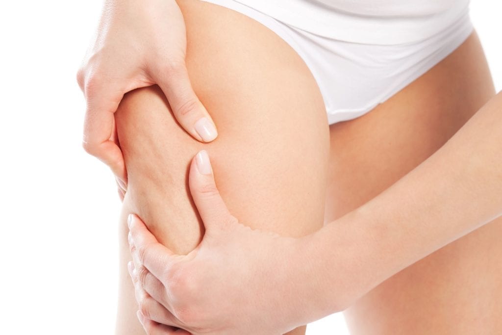 peau orange cuisses