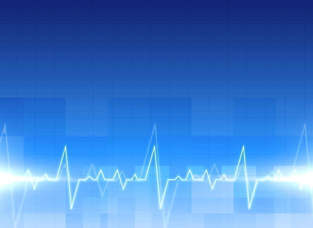 electrocardiogramme guide