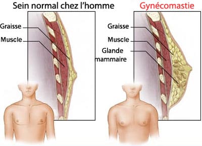 gynecomastie-anatomie