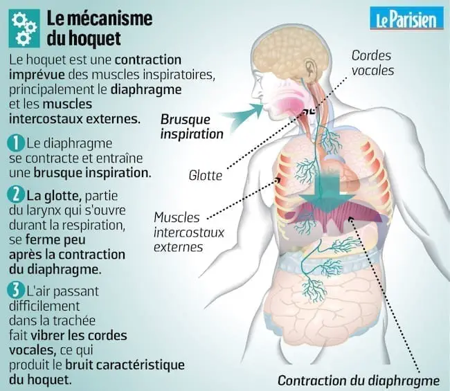 le hoquet